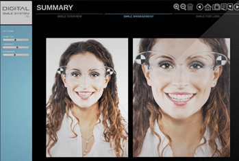 Digital Smile System