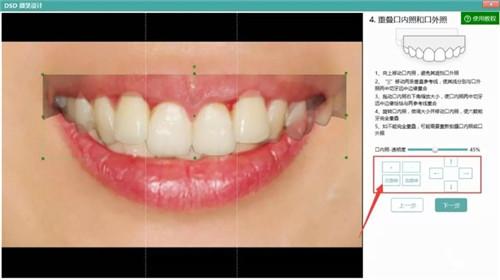 牙医管家口腔管理软件
