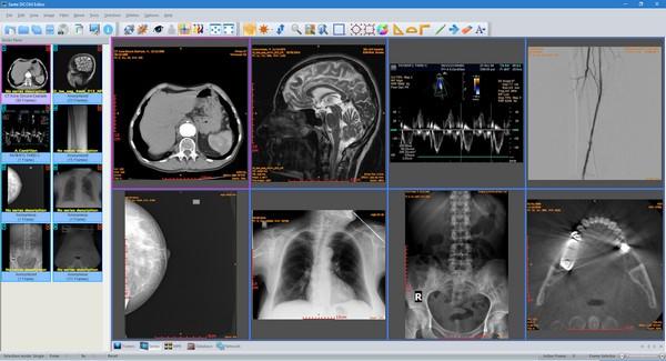Sante DICOM Editor